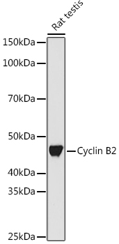 Cyclin B2 Rabbit mAb