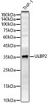Western blot - ULBP2 Rabbit pAb (A8264)