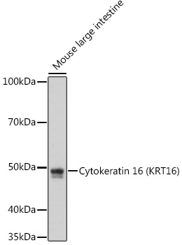 Cytokeratin 16 (KRT16) Rabbit mAb