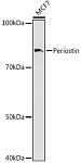 Western blot - Periostin Rabbit mAb (A9009)
