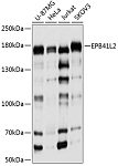Western blot - EPB41L2 Rabbit pAb (A9101)