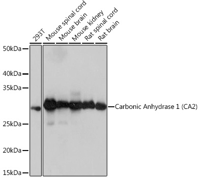 Carbonic Anhydrase 2 (CA2) Rabbit mAb