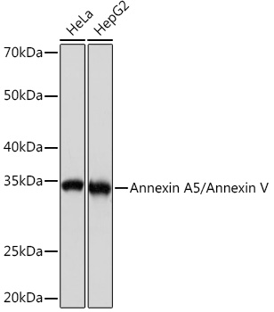 Annexin A5/Annexin V Rabbit mAb
