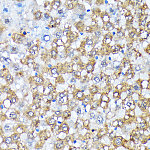 Western blot - Casein Kinase 1 alpha (CSNK1A1) Rabbit mAb (A9308)