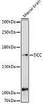 Western blot - DCC Rabbit pAb (A9372)