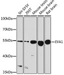 Western blot - EYA1 Rabbit pAb (A9534)
