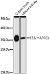 Western blot - EB3/MAPRE3 Rabbit pAb (A9591)