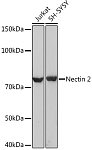 Western blot - Nectin 2/CD112 Rabbit mAb (A9622)