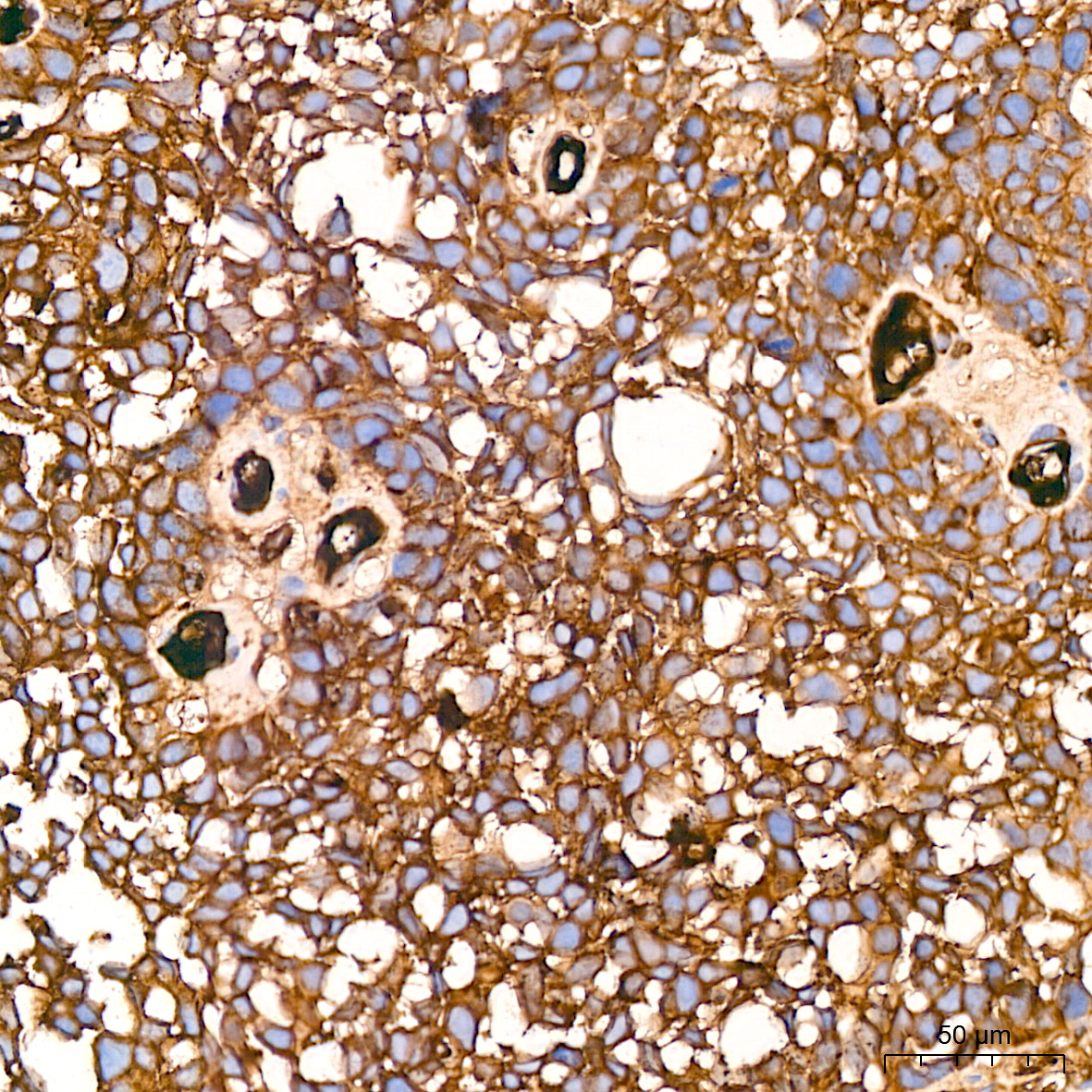 Alpha 2 Macroglobulin A2m Rabbit Mab Monoclonal Antibodies Abclonal 4762