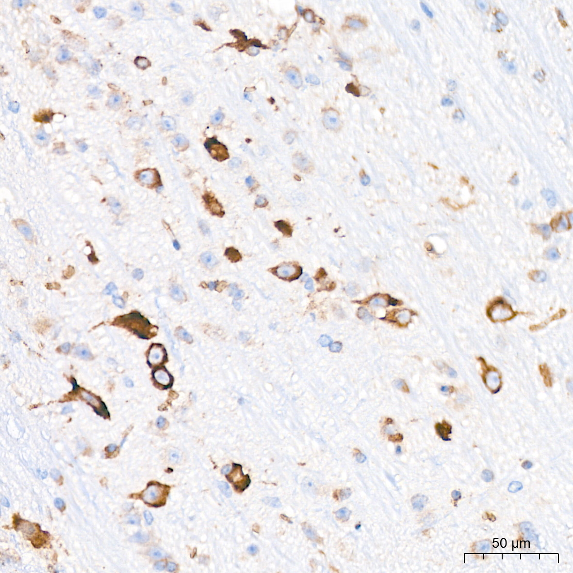 Alpha 2 Macroglobulin A2m Rabbit Mab Monoclonal Antibodies Abclonal 4208