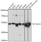 Western blot - β-Tubulin Rabbit pAb (AC015)