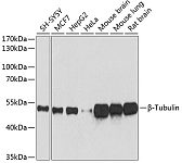 Western blot - β-Tubulin Mouse mAb (AC021)