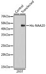 Western blot - HRP-conjugated Mouse anti His-Tag mAb (AE028)