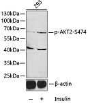 Western blot - Phospho-AKT2-S474 Rabbit pAb (AP0005)