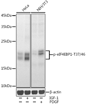 Phospho-eIF4EBP1-T37/46 Rabbit pAb