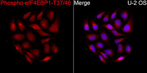 Western blot - Phospho-eIF4EBP1-T37/46 Rabbit pAb (AP0030)