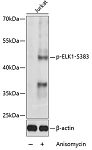 Western blot - Phospho-ELK1-S383 Rabbit pAb (AP0033)
