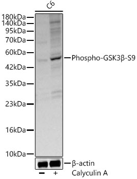 ABclonal:Western blot - Phospho-GSK3β-S9 Rabbit pAb (AP0039)
