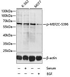 Western blot - Phospho-MEF2C-S396 Rabbit pAb (AP0075)