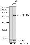 Western blot - Phospho-c-Myc-S62 Rabbit pAb (AP0082)