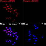 Immunofluorescence - Phospho-p53-S15 Rabbit pAb (AP0083)