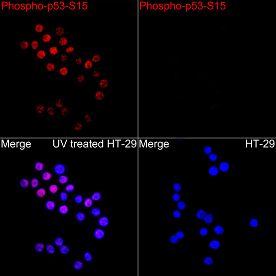 Phospho-p53-S15 Rabbit pAb