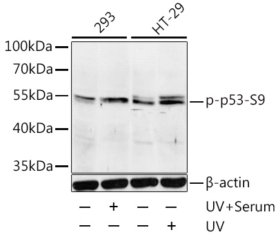 Phospho-p53-S9 Rabbit pAb