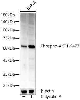 Phospho-AKT1-S473 Rabbit pAb