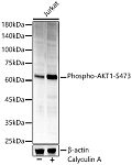 Western blot - Phospho-AKT1-S473 Rabbit pAb (AP0098)