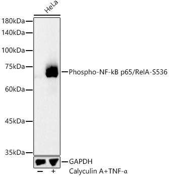 Phospho-NF-kB p65/RelA-S536 Rabbit pAb