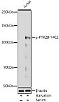Western blot - Phospho-PTK2B-Y402 Rabbit pAb (AP0214)