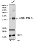Western blot - Phospho-HSP27/HSPB1-S78 Rabbit pAb (AP0236)