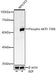 Western blot - Phospho-AKT1-T308 Rabbit pAb (AP0304)