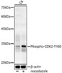 Western blot - Phospho-CDK2-T160 Rabbit pAb (AP0325)