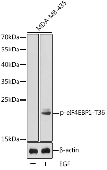 Phospho-eIF4EBP1-T36 Rabbit pAb