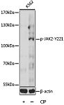 Western blot - Phospho-JAK2-Y221 Rabbit pAb (AP0374)