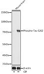 Western blot - Phospho-Tau-S262 Rabbit pAb (AP0397)