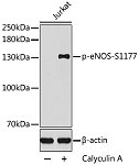 Western blot - Phospho-eNOS-S1177 Rabbit pAb (AP0421)