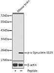 Western blot - Phospho-α-Synuclein-S129 Rabbit pAb (AP0450)