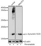 Western blot - Phospho-α-Synuclein-Y133 Rabbit pAb (AP0451)