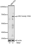 Western blot - Phospho-SRC Family-Y416 Rabbit pAb (AP0452)