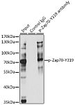 Immunoprecipitation - Phospho-ZAP70-Y319 Rabbit pAb (AP0467)