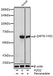 Western blot - Phospho-ZAP70-Y493 Rabbit pAb (AP0468)