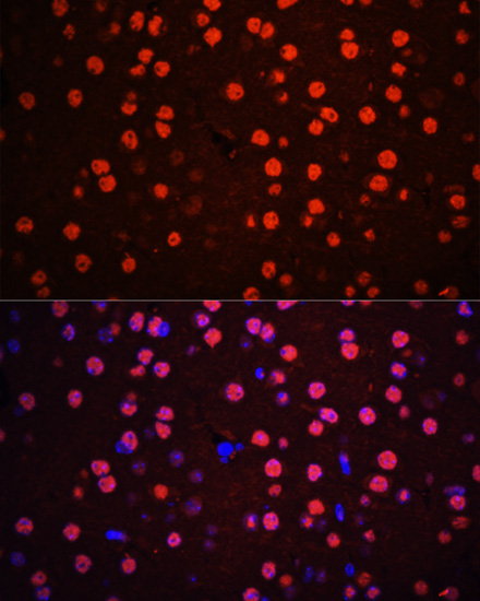 Phospho-p38 MAPK-T180/Y182 Rabbit pAb-Phospho-specific Antibodies