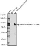Western blot - Phospho-p90Rsk/RSK1/RPS6KA1-S380 Rabbit pAb (AP0562)