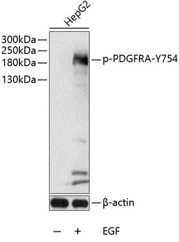 Phospho-PDGFR alpha-Y754 Rabbit pAb