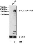 Western blot - Phospho-PDGFR alpha-Y754 Rabbit pAb (AP0568)