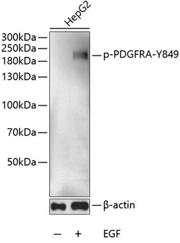 Phospho-PDGFR alpha-Y849 Rabbit pAb