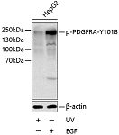 Western blot - Phospho-PDGFR alpha-Y1018 Rabbit pAb (AP0615)