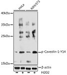 Western blot - Phospho-Caveolin-1-Y14 Rabbit pAb (AP0742)